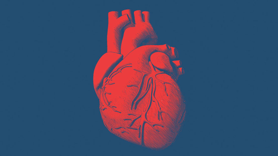 monk-heart transplant-transplant surgery-heart donor-transplant list-cardiologists
