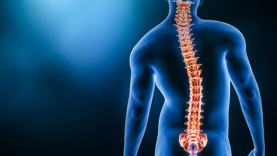 scoliosis-spine health-quality of life-health problems-