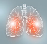 idiopathic pulmonary fibrosis-IPF-disease