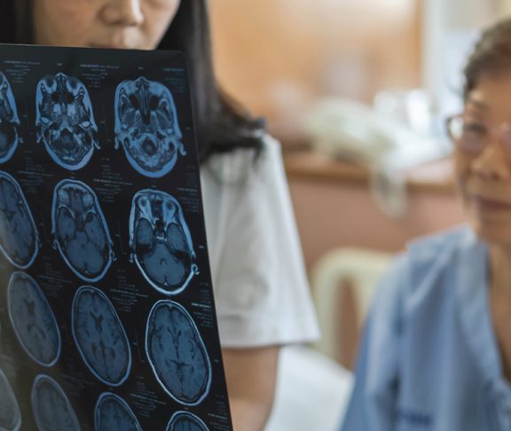 Neurologist showing woman scans of her brain