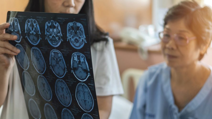 Neurologist showing woman scans of her brain