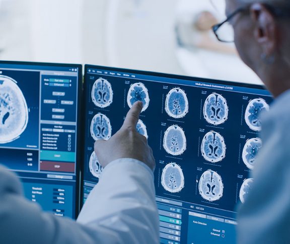 fasd doctors examining brain scan