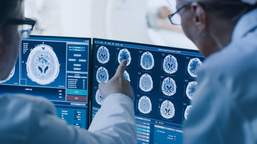 doctors examining brain scan