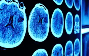 close up of neurology