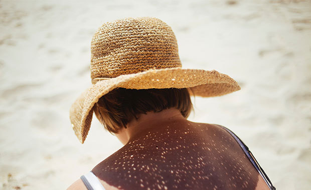 Kvinna med solhatt. Foto: Unsplash