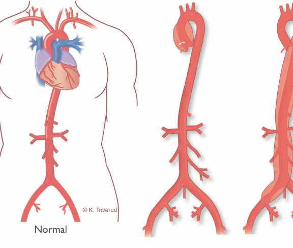 aorta illustration