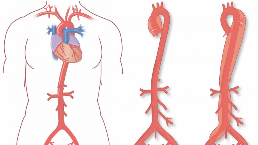aorta illustration