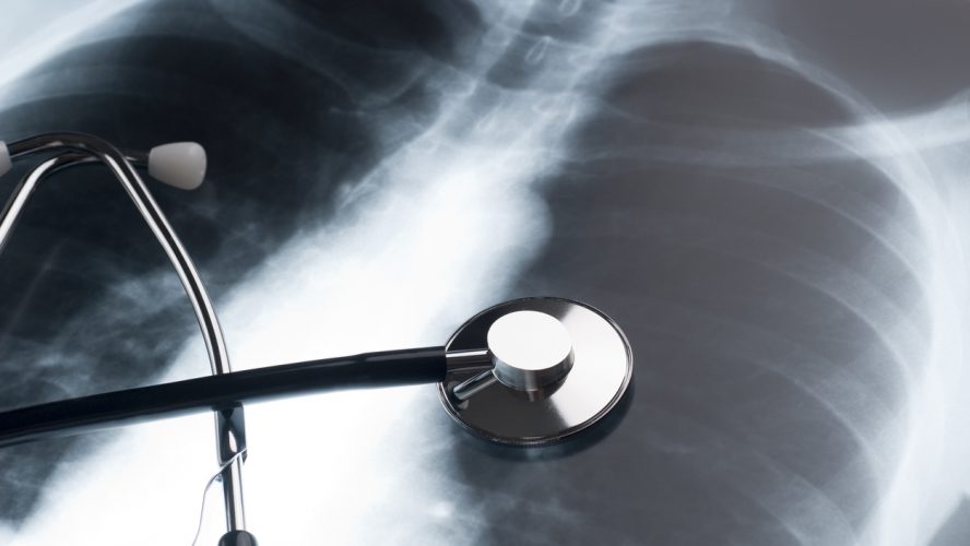 Physician stethoscope on an XRAY of a human chest