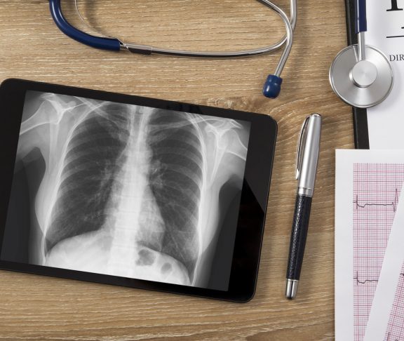 Digital tablet with lung x-ray, electrocardiogram, stethoscope and patient informations on wooden desk.