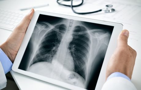 doctor observing a chest radiograph in a tablet
