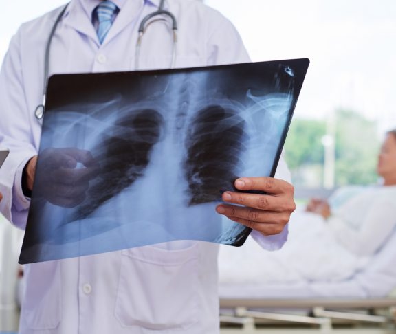 Examining chest x-ray