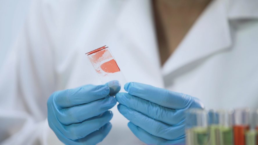 Medical worker analyzing microbiological specimens, blood sample, HIV test