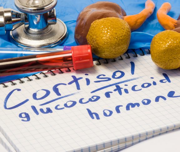 Cortisol glucocorticoid hormone diagnostic concept photo. Figure of adrenal glands (cortex) with kidneys which produces this steroid hormone, next to stethoscope, lab test tubes, note labeled cortisol