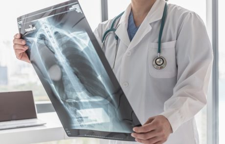 Doctor with radiological chest x-ray film for medical diagnosis on patient's health on asthma, lung disease and bone cancer illness