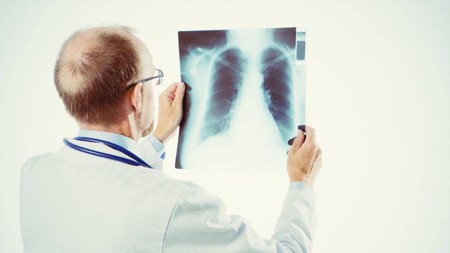 Rear view of a doctor holding up an X-ray of someone's chest and looking at it.