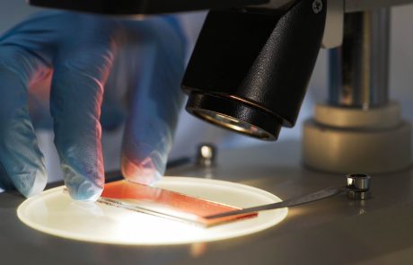 Medical scientist studying blood sample under microscope, biochemical research