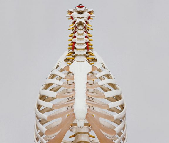 spine pain MSK
