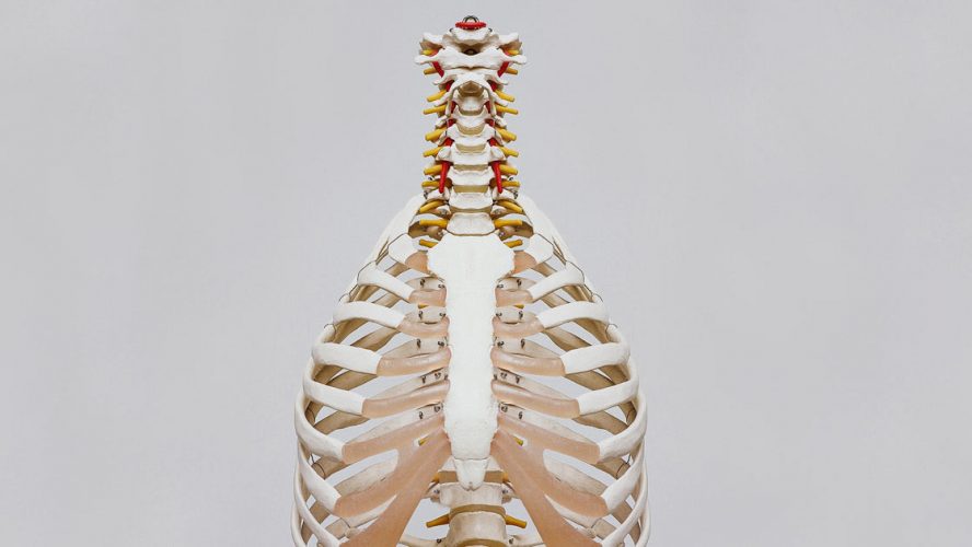 spine pain MSK