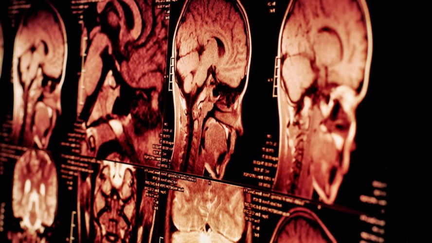 imaging scans brain