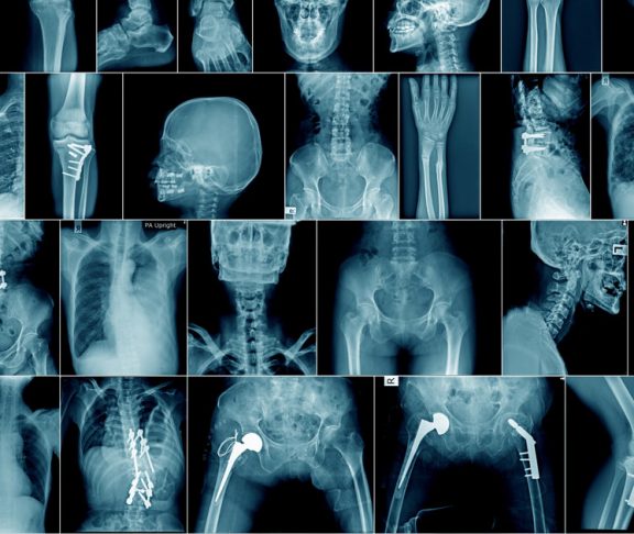 X ray radiology doctors