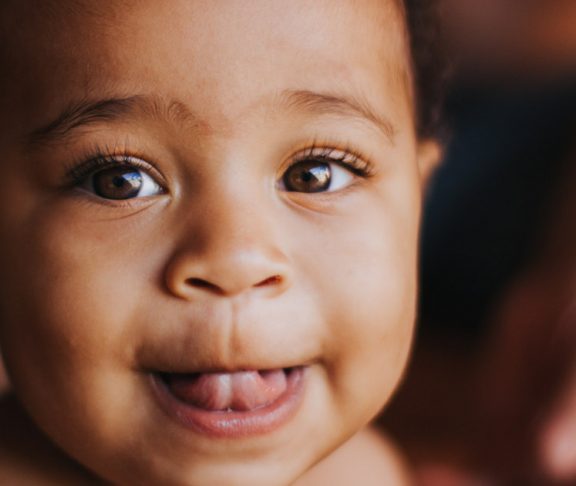 rare diseases baby start life