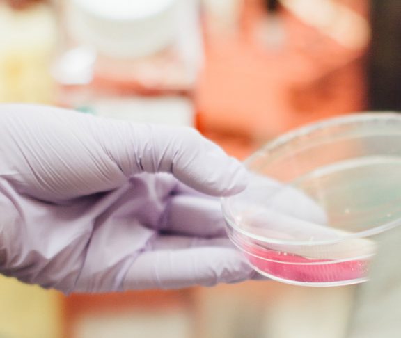 rare diseases research petri dish