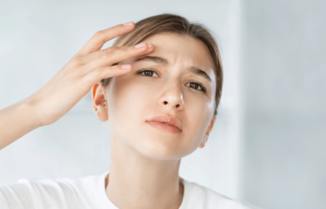 Sensitive skin acne problem woman touching face