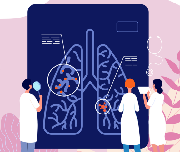 Pulmonology concept. Lung diagnosis, tuberculosis pneumonia treatment. Smoking risks, doctors respiratory health care utter vector banner - stock illustration