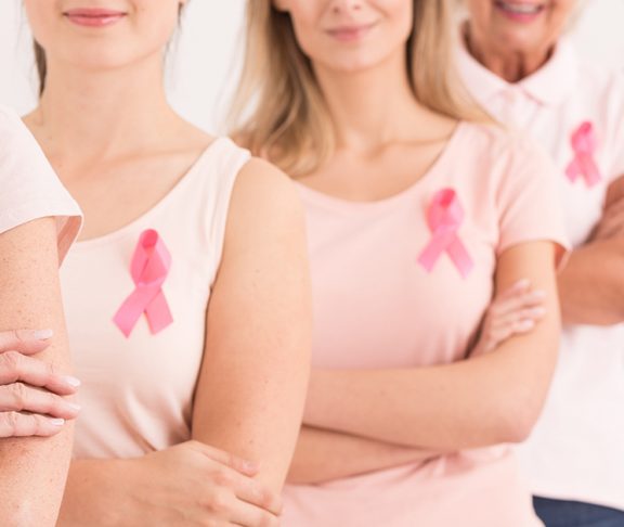 Kvinder står med knæk cancer mærker på trøjen