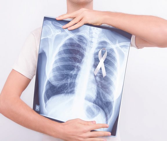 Oncological lung cancer disease concept. Guy male man holding medical lung body x-ray photo with pinned white ribbon as a symbol of lung cancer on white isolated background