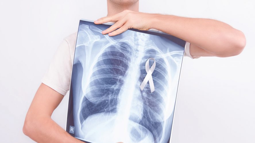 Oncological lung cancer disease concept. Guy male man holding medical lung body x-ray photo with pinned white ribbon as a symbol of lung cancer on white isolated background