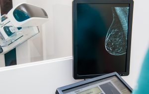Mammogram snapshot of breasts of a female patient on the monitor with undergoing mammography test on the background. Selective focus
