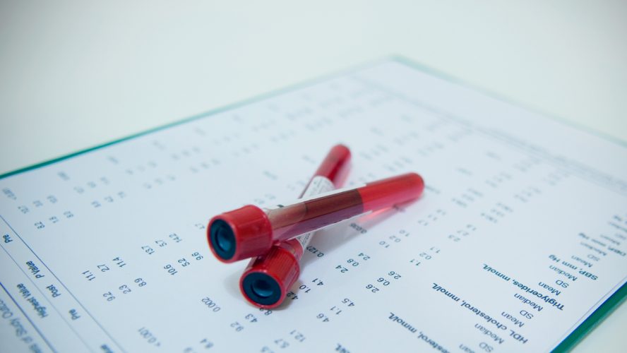 Hematology blood analysis report with lavender color blood sample collection tubes.