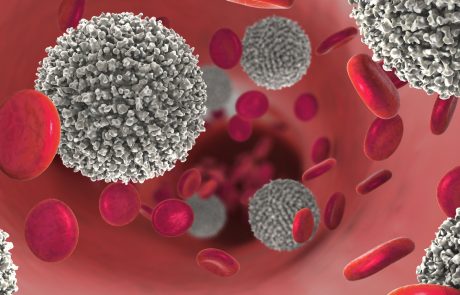 3d illustration of the strong increase of non-functional white blood cells called leukemia cells leading to blood cancer disease