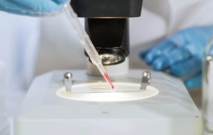 Biochemist preparing slide with blood sample, examines it under microscope