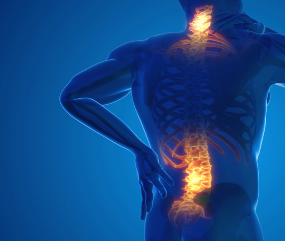 Pain in the back and neck joint 3D illustration