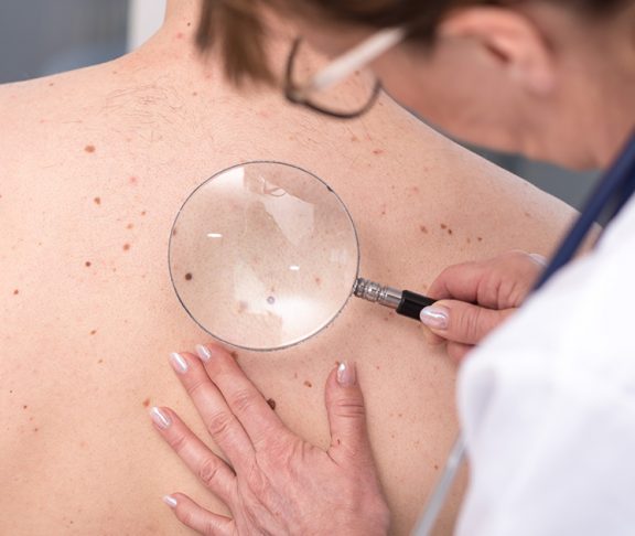 Cosmetisch dermatoloog onderzoekt huid van een patiënt