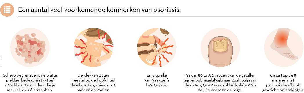 Infographic kenmerken psoriasis