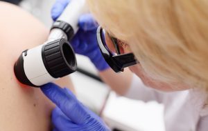 Arts onderzoekt huid patiënt op melanoom
