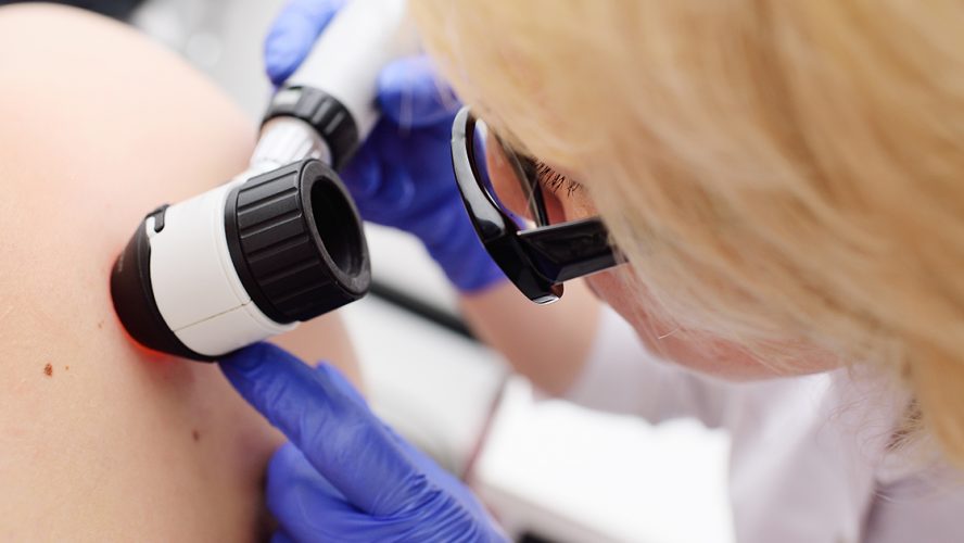 Arts onderzoekt huid patiënt op melanoom